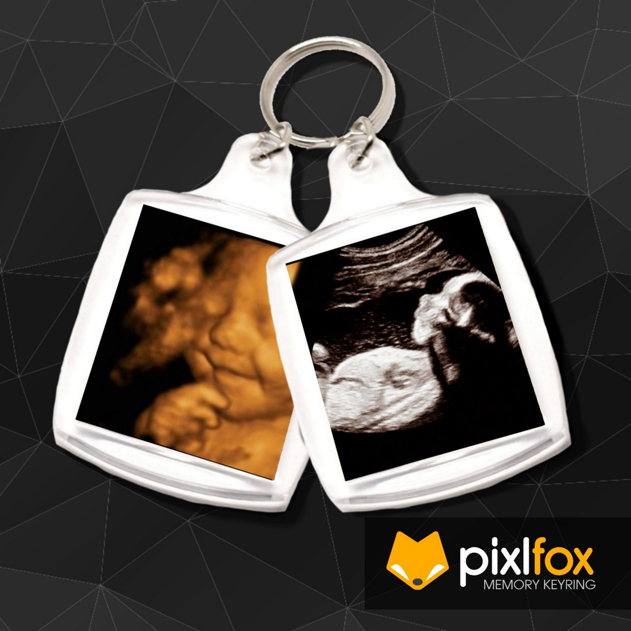 Personalised Ultrasound 3D 4D Baby Photo Keyring (45 x 35mm)